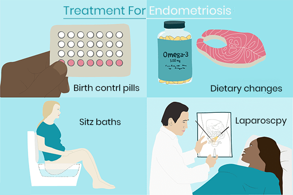 Treatment For Endometriosis